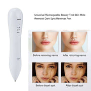 Spot Removal Pen for dark spot and mole removal with before and after results on facial skin