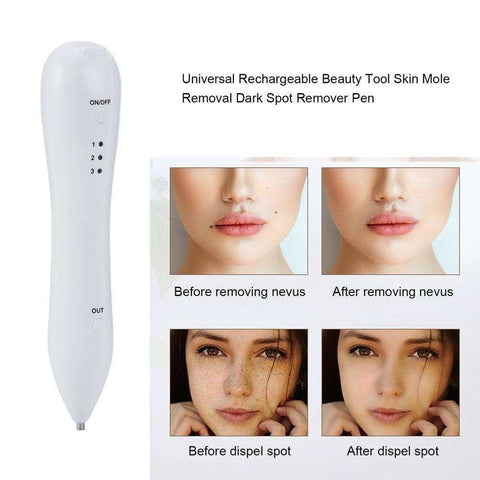 Spot Removal Pen for dark spot and mole removal with before and after results on facial skin