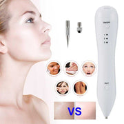 Spot Removal Pen device with fine tips for dark spot and skin tag removal on face and body