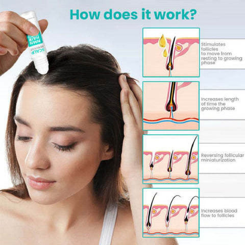 Woman applying ScalpReboost NMN hair growth roller to scalp with infographic showing follicle stimulation and increased blood flow.