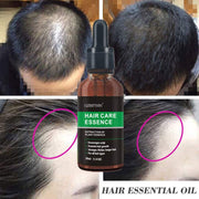 Hair Growth Oil promoting scalp health and thicker hair with natural botanicals before and after results