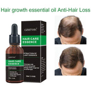 Hair Growth Oil bottle with packaging and before after results for hair loss treatment