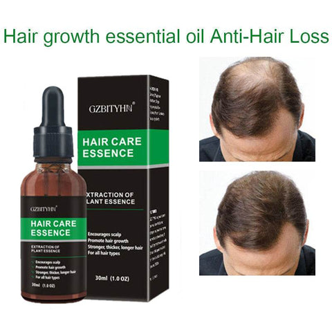 Hair Growth Oil bottle with packaging and before after results for hair loss treatment