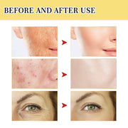 Before and after images showing improved skin hydration, reduced wrinkles, smoother texture, and diminished acne scars using Snail Serum Collagen Facial Serum Original