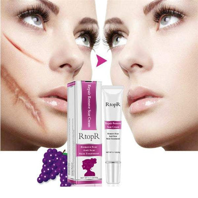 Skin repair cream for scar removal and skin rejuvenation with natural extracts and fast absorption