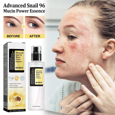 Snail Serum Collagen Facial Serum for skin repair and hydration with before and after results on facial redness