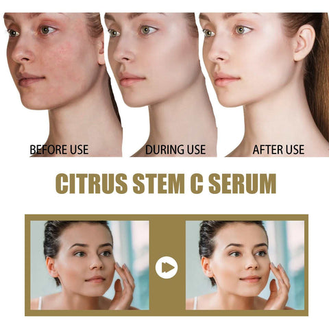 Hoygi Citrus Stem C Serum before and after results showing reduced wrinkles and improved skin elasticity with radiant complexion