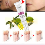 Skin repair cream tube with before and after scar healing results and skin tissue regeneration illustration