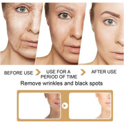Before and after images showing effects of Dark Spot Correction Serum removing wrinkles and black spots