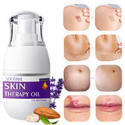30ml Skin Treatment Oil for cellulite, stretch mark repair, and skin nourishment with natural ingredients.