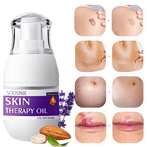 30ml Skin Treatment Oil for cellulite, stretch mark repair, and skin nourishment with natural ingredients.