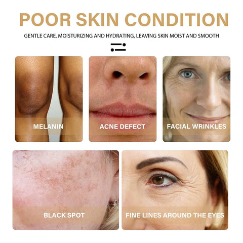 Dark Spot Correction Serum targeting melanin, acne defects, facial wrinkles, black spots, and fine lines around eyes for brighter skin