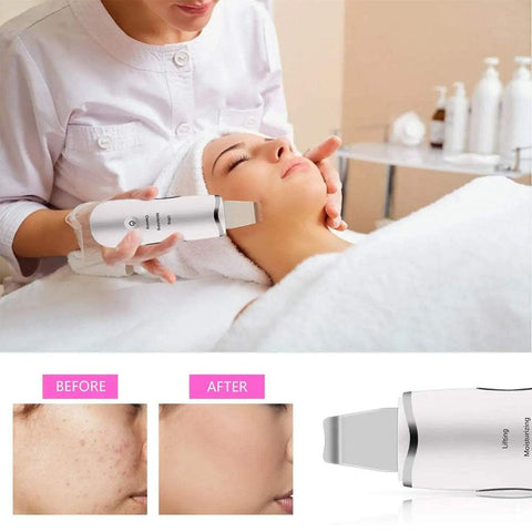 Ultrasonic Facial Spatula used for deep cleansing and skin rejuvenation with before and after results showing clearer skin
