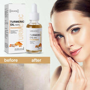 Turmeric oil dark spot correction serum with before and after skin brightening results and a smiling woman touching her face