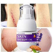 Skin Treatment Oil for stretch marks, scars, and cellulite repair with natural ingredients and deep hydration.