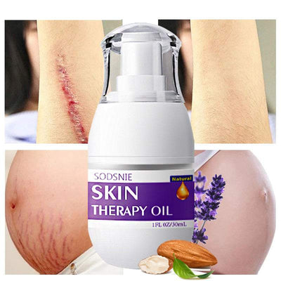 Skin Treatment Oil for stretch marks, scars, and cellulite repair with natural ingredients and deep hydration.